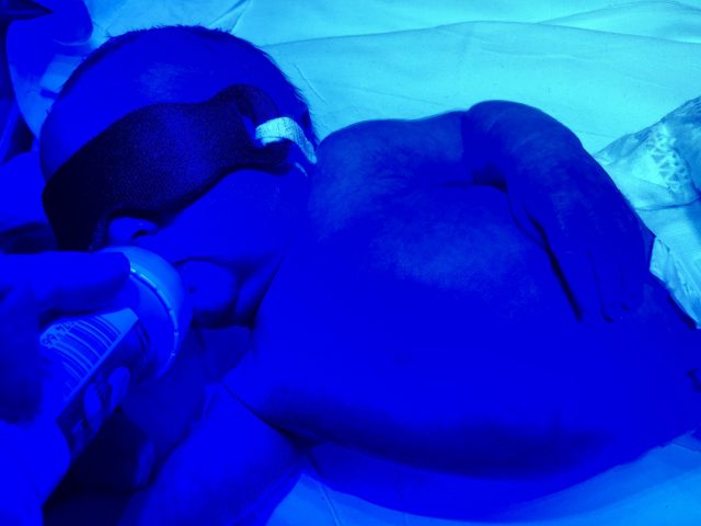 Baby Stone under a UV light